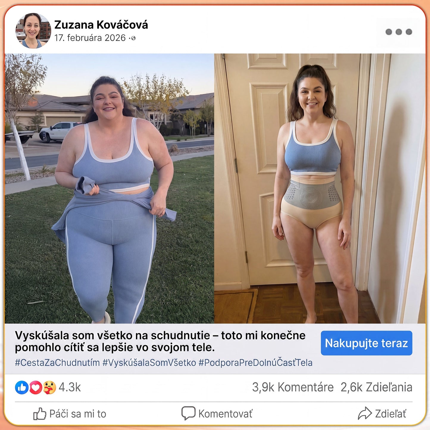 Oficiálny obchod značky |✅𝑷𝑨𝑼𝑹𝑨𝑱𝑼®  MORINGA & BERBERÍN 4V 1 MIKROČASTICOVÉ FORMOVANIE & ŠORTKY NA SPALOVANIE TUKU🧨