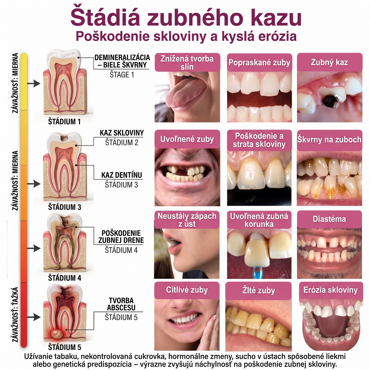 Rolimey® DenPerm – Prírodný gél na vypĺňanie defektov skloviny pri liečbe kazových lézií🧨