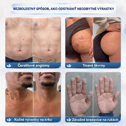 𝑷𝒊𝒄𝒅𝒐® 7-𝒅ň𝒐𝒗ý 𝒌𝒓é𝒎 𝒏𝒂 𝒌𝒐ž𝒏é 𝒗ý𝒓𝒂𝒔𝒕𝒌𝒚 𝒂 𝒑𝒊𝒈𝒎𝒆𝒏𝒕𝒐𝒗é š𝒌𝒗𝒓𝒏𝒚 ✅(𝒃𝒆𝒛𝒃𝒐𝒍𝒆𝒔𝒕𝒏á 𝒇𝒐𝒓𝒎𝒖𝒍𝒂 – 𝒃𝒆𝒛 𝒋𝒂𝒛𝒊𝒆𝒗)🍉