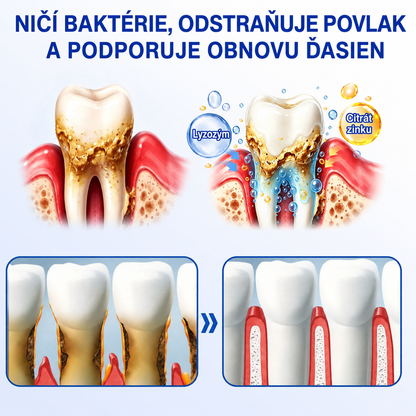 👨‍⚕️🦷 Evolvion® GumRevive regeneračný gél na parodont🎁