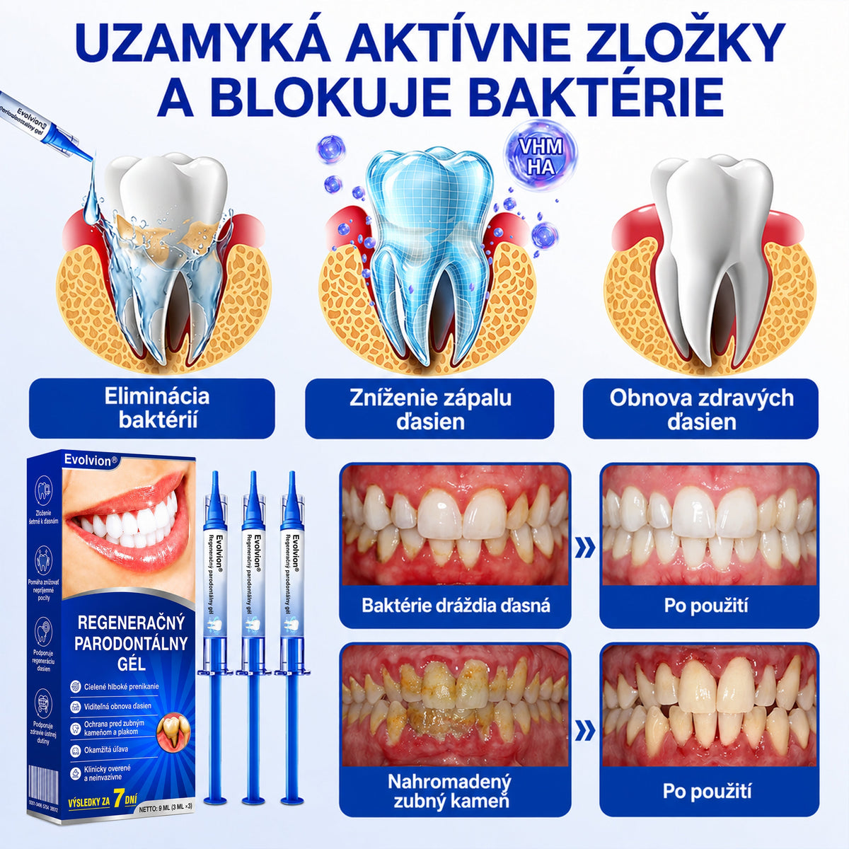 👨‍⚕️🦷 Evolvion® GumRevive regeneračný gél na parodont🎁