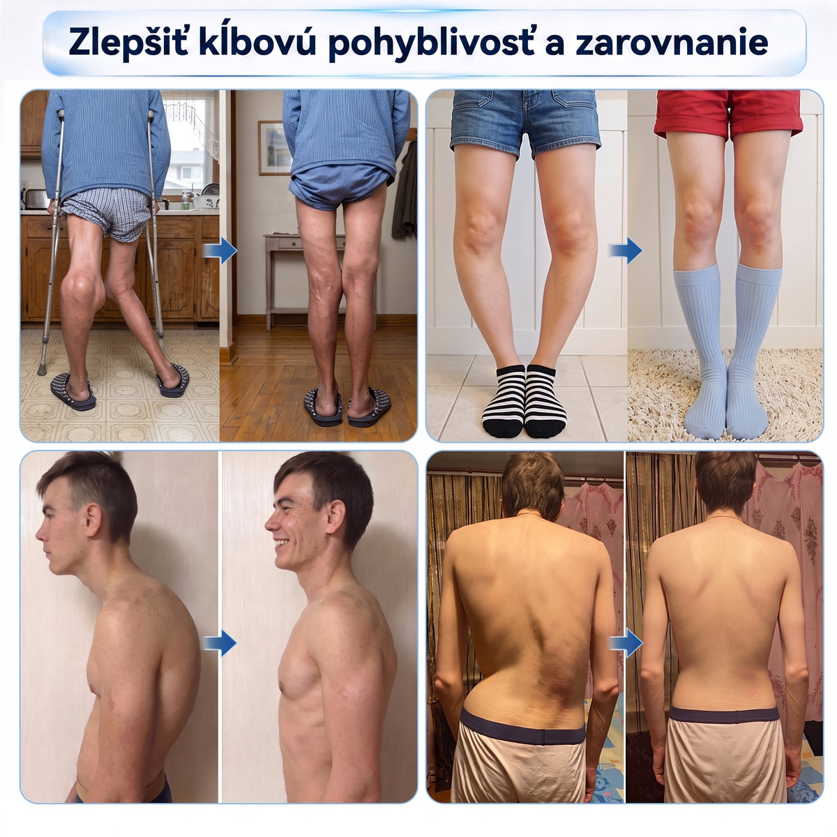 OFICIÁLNY OBCHOD | IFMAGIC® 0,05 mm Mikroneedle Rýchlo Pôsobiaci Roll-On na Úľavu Kĺbov a Kostí🎇