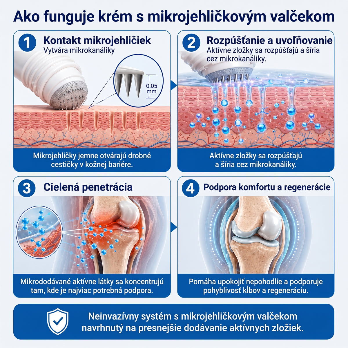 OFICIÁLNY OBCHOD | IFMAGIC® 0,05 mm Mikroneedle Rýchlo Pôsobiaci Roll-On na Úľavu Kĺbov a Kostí🎇