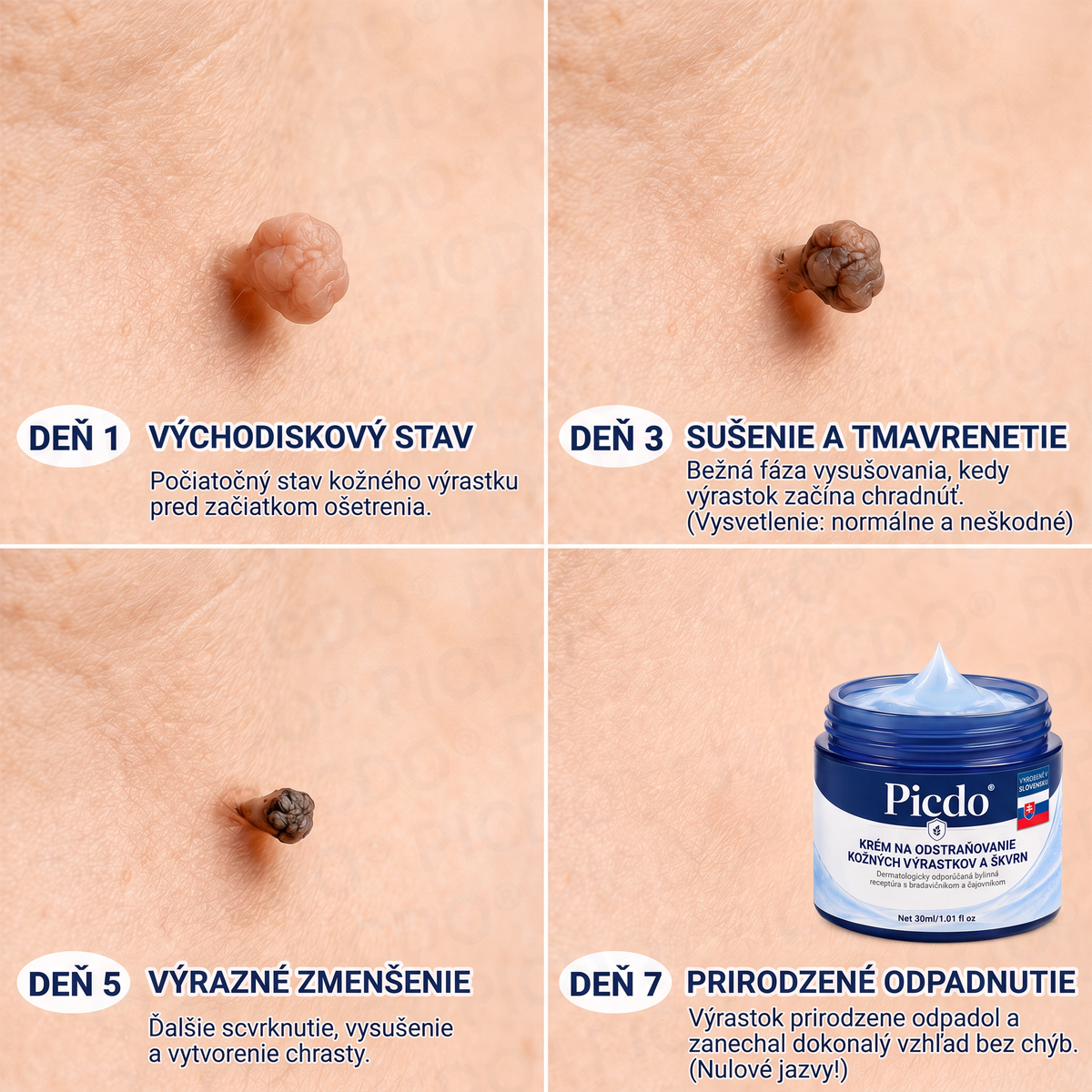 𝑷𝒊𝒄𝒅𝒐® 7-𝒅ň𝒐𝒗ý 𝒌𝒓é𝒎 𝒏𝒂 𝒌𝒐ž𝒏é 𝒗ý𝒓𝒂𝒔𝒕𝒌𝒚 𝒂 𝒑𝒊𝒈𝒎𝒆𝒏𝒕𝒐𝒗é š𝒌𝒗𝒓𝒏𝒚 ✅(𝒃𝒆𝒛𝒃𝒐𝒍𝒆𝒔𝒕𝒏á 𝒇𝒐𝒓𝒎𝒖𝒍𝒂 – 𝒃𝒆𝒛 𝒋𝒂𝒛𝒊𝒆𝒗)🍉
