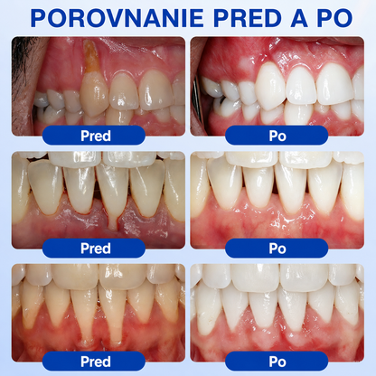 👨‍⚕️🦷 Evolvion® GumRevive regeneračný gél na parodont🎁