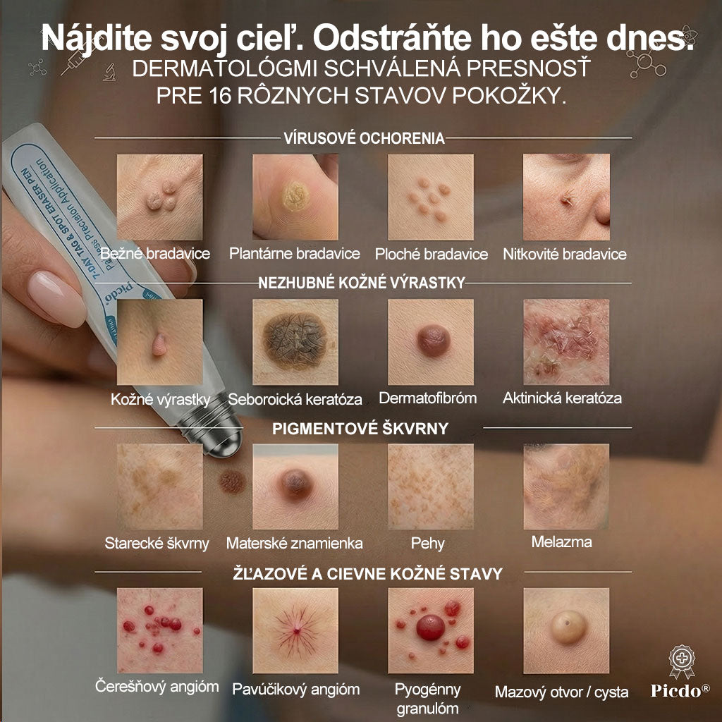 𝐎𝐟𝐢𝐜𝐢𝐚𝐥𝐧𝐲 𝐨𝐛𝐜𝐡𝐨𝐝 𝐦𝐚𝐫𝐤𝐲 | ✅️👩‍⚕️𝐏i𝐜𝐝o® 7dni Prípravok na odstránenie kožných výrastkov a pigmentových škvŕn (bezbolestný roll-on aplikátor bez jaziev) ⭐
