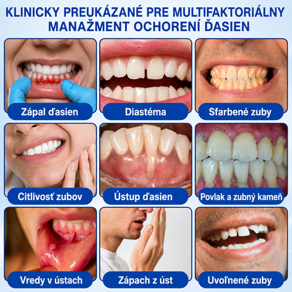 👨‍⚕️🦷 Evolvion® GumRevive regeneračný gél na parodont🎁