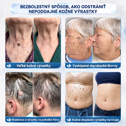 𝑷𝒊𝒄𝒅𝒐® 7-𝒅ň𝒐𝒗ý 𝒌𝒓é𝒎 𝒏𝒂 𝒌𝒐ž𝒏é 𝒗ý𝒓𝒂𝒔𝒕𝒌𝒚 𝒂 𝒑𝒊𝒈𝒎𝒆𝒏𝒕𝒐𝒗é š𝒌𝒗𝒓𝒏𝒚 ✅(𝒃𝒆𝒛𝒃𝒐𝒍𝒆𝒔𝒕𝒏á 𝒇𝒐𝒓𝒎𝒖𝒍𝒂 – 𝒃𝒆𝒛 𝒋𝒂𝒛𝒊𝒆𝒗)🍉
